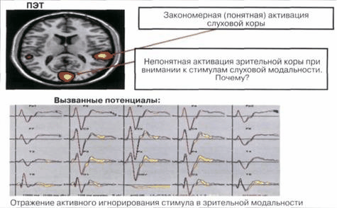 mehanizmy-deyatelnosti-mozga